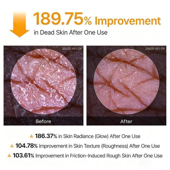Veilosy Peel Shot - Body Exfoliating Spray with Kojic Acid and Turmeric