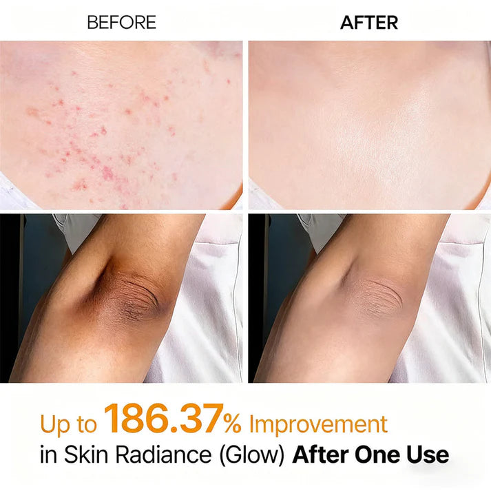 Veilosy Peel Shot - Body Exfoliating Spray with Kojic Acid and Turmeric